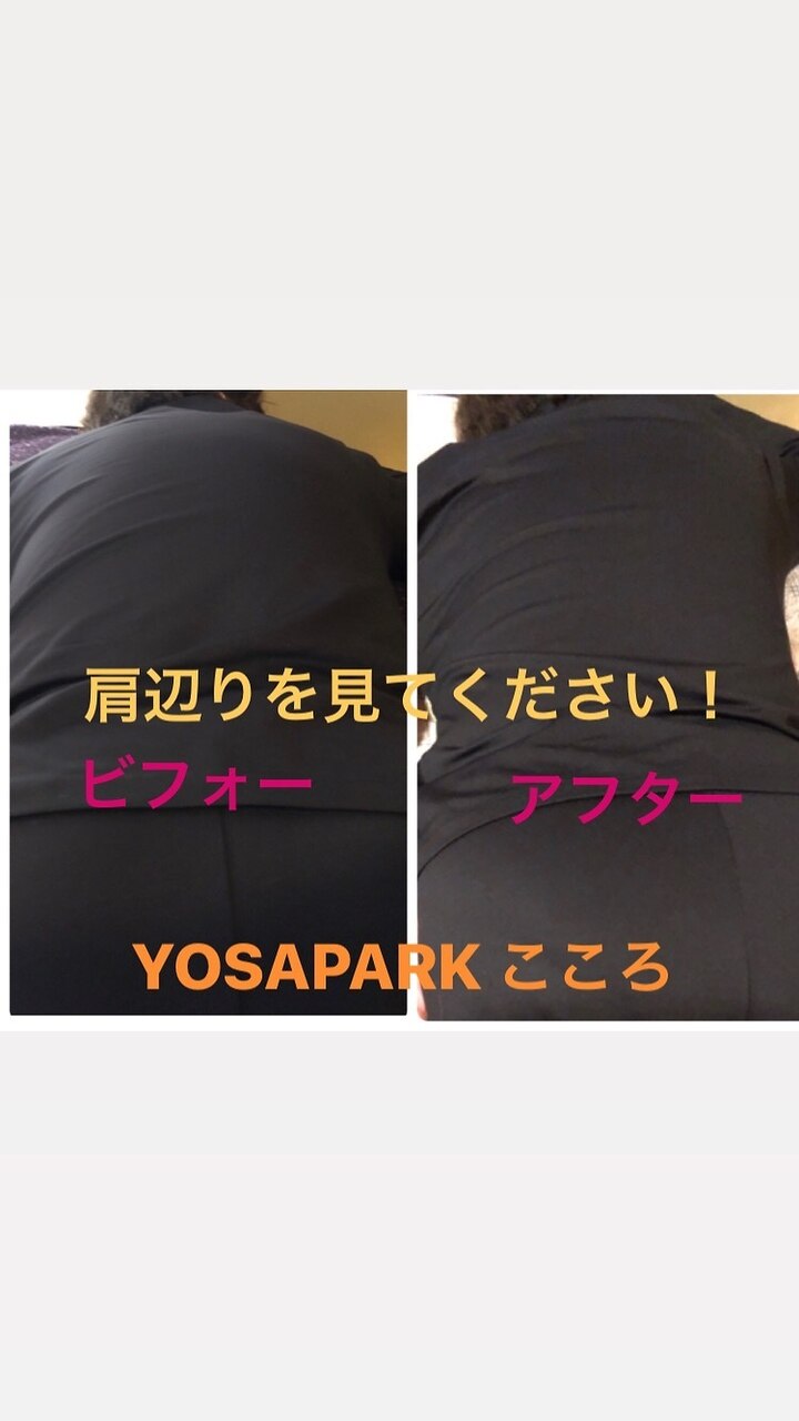 肩・首・背中集中ケア